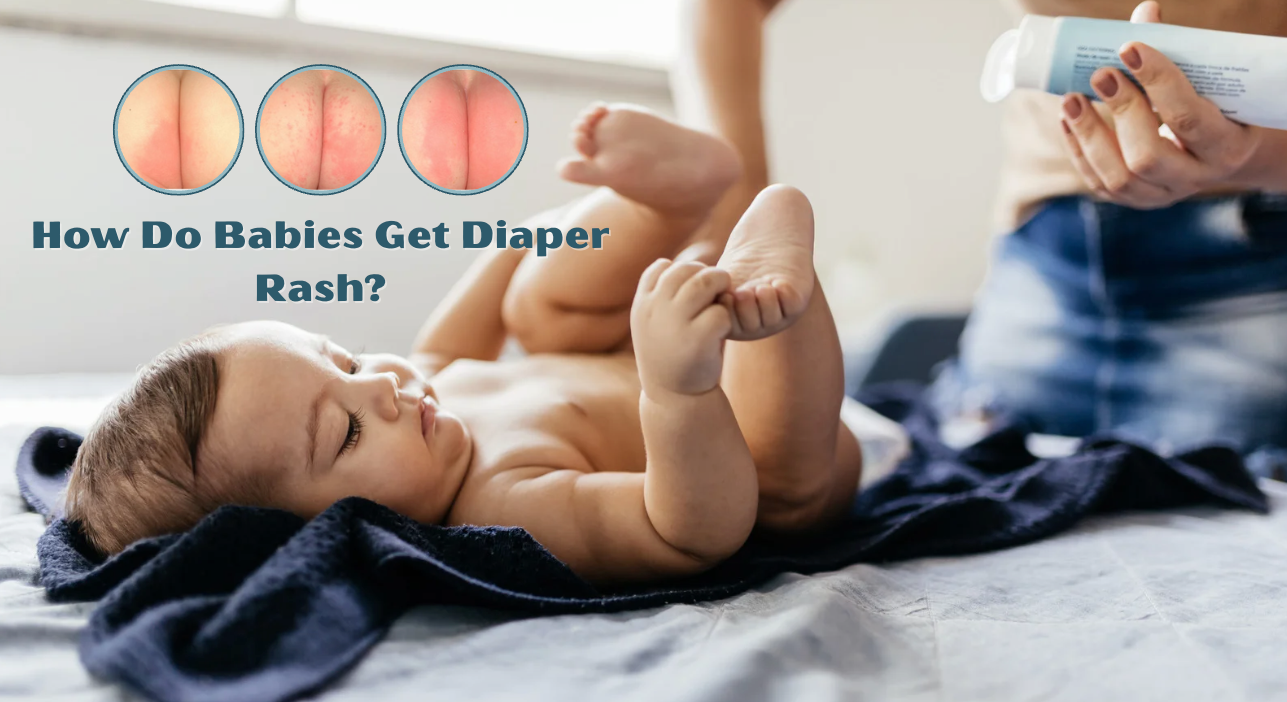 How Do Babies Get Diaper Rash And How To Prevent It